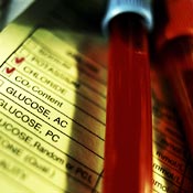 blood-sugar